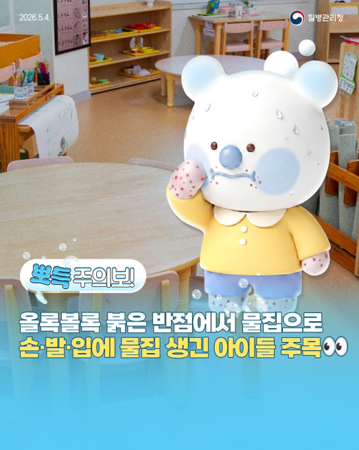 수족구병 주의! 수족구병 예방수칙 안내